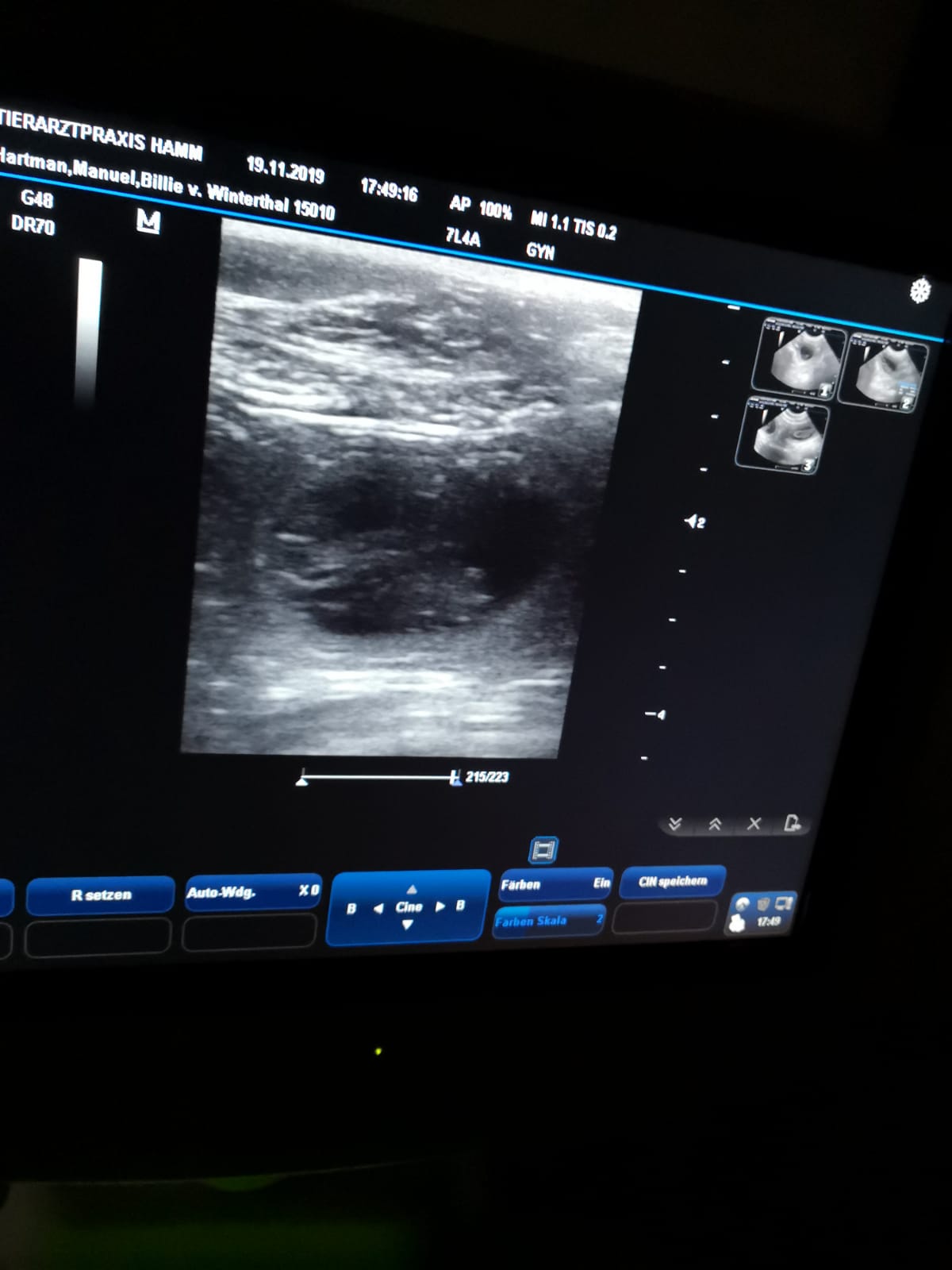 Ultraschall 1